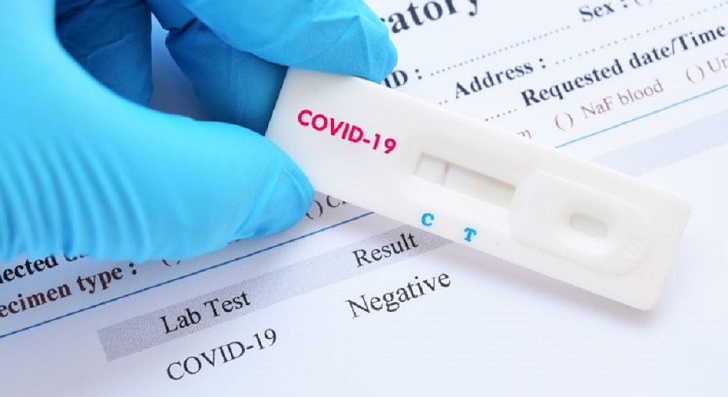 España adquiere más de 50.000 tests defectuosos para el coronavirus 