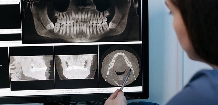 Sanidad reparte 68 millones de euros para mejorar los servicios de salud bucodental