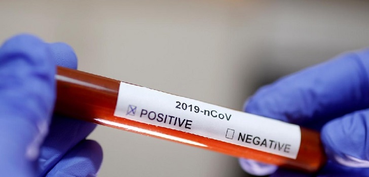 Prueba diagnóstica para detectar el coronavirus BioMérieux lanza dos tests serológicos para la detección de anticuerpos del Covid-19