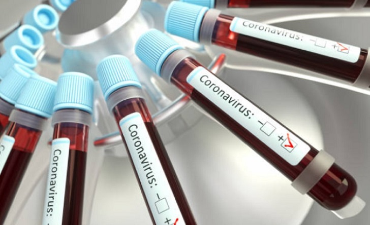 Moderna podría tener lista la vacuna contra el coronavirus en 2021