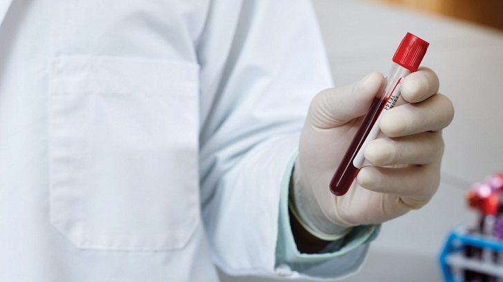 El sector de las pruebas ‘in vitro’, en alerta: el 22% de los test dejarán de fabricarse en 2022