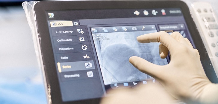 El Hospital de Valencia confía a Philips un equipo de hemodinámica por 968.000 euros