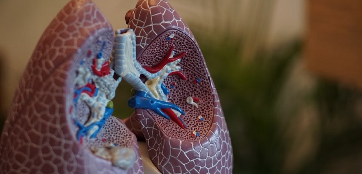 La fibrosis pulmonar idiopática cuesta 27.000 euros por paciente al SNS