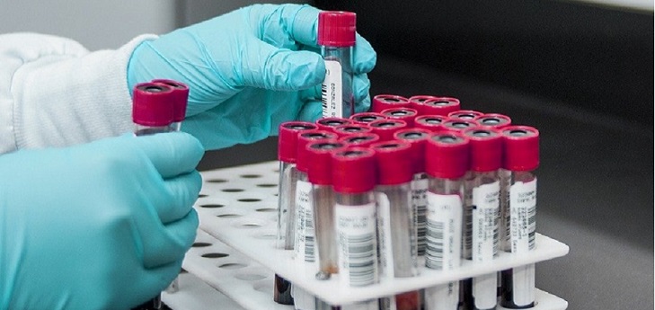 Inveready lanzará otro fondo para respaldar a empresas biotecnológicas