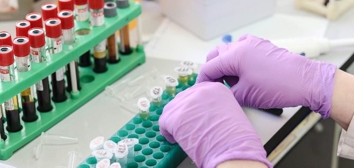 Cantabria licita por 7,3 millones de euros material sanitario