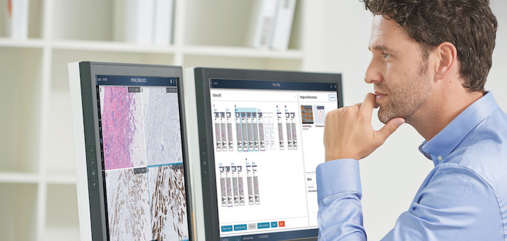 Tecnología de Philips e Ibex Medical Analytics Philips e Ibex Medical Analytics se alían para acelerar la patología digital impulsada por IA