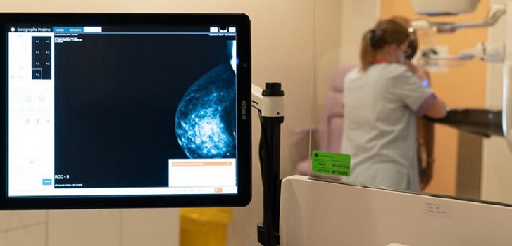 Ribera invierte 231.000 euros en la puesta en marcha de un nuevo mamógrafo en Denia