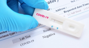 Andalucía adjudica por 15,7 millones el suministro de pruebas de antígenos del Covid-19