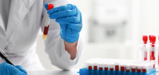 Biocroos capta un millón del Cdti e Inverbio para avanzar en diagnóstico ‘in vitro’