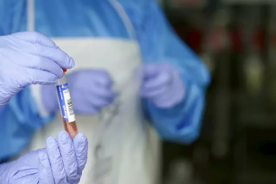 España realiza tres millones de pruebas del Covid-19 desde el inicio de la pandemia