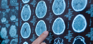 Accure Therapeutics otorga la licencia de un fármaco neuroprotector a Oculis