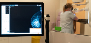 Ribera invierte 231.000 euros en un nuevo mamógrafo en Denia
