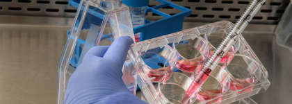La EMA avala la aprobación de la primera terapia de edición génica para dos enfermedades