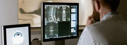 El Consejo de Ministros aprueba un Acuerdo Marco para la compra de equipos de radiología 