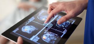 Análisis de imagen y terapias online: cuando el ‘medtech’ se pone ‘la bata blanca’