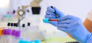 Universal Diagnostics, horizonte 2021: salto al Nasdaq y comercializaci&oacute;n de su test