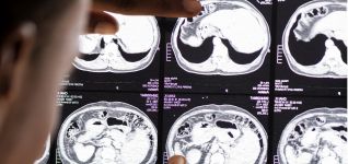 Valencia aprueba el decreto que regula la reversi&oacute;n del servicio de radiodiagn&oacute;stico por imagen