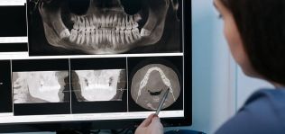 Sanidad reparte 68 millones de euros para mejorar los servicios de salud bucodental