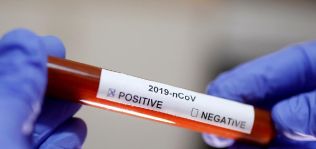 BioMérieux lanza dos tests serológicos para la detección de anticuerpos del Covid-19