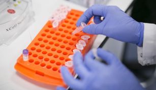 Los precios de la industria ‘farma’ en España se incrementan un 2,3% en octubre