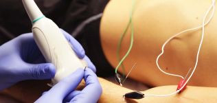 Ionclinics crece en el extranjero con una filial en Brasil